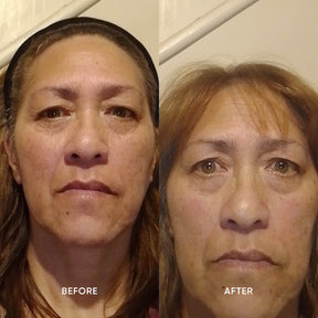 ManukaRx Restorative Eye Cream customer before and after images